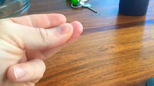 Кончик пальца отрезал! швы Спустя 5 лет после снятия швов смотреть онлайн