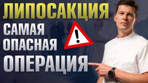 Липосакция: самая опасная операция в пластической хирургии? Мнение пластического хирурга