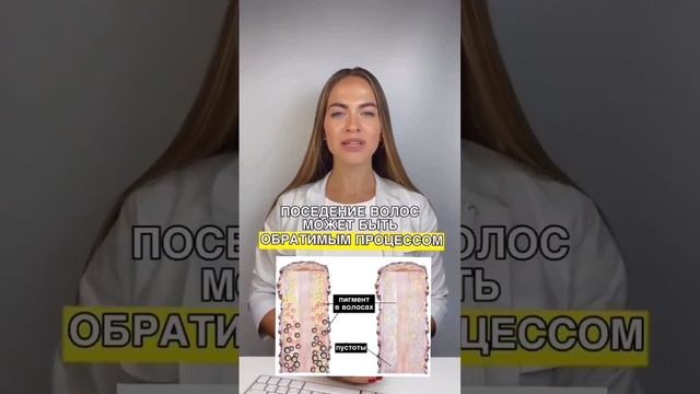 Причины ранней седины#седина#волосы #старение#здоровьеволос #советыдоктора#лечениезаболеваний#short