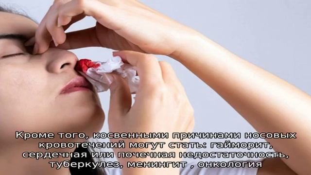 У ребенка кровь из носа – какие причины называет Комаровский смотреть онлайн
