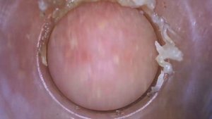 Вакуумные приборы для удаления черных точек - демонстрация работы