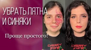 Как просто убрать пигментные пятна и синяки