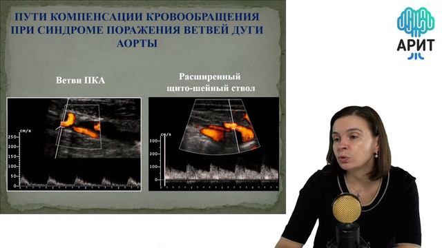 Онлайн-лекция «Ультразвуковое исследование пациентов с неспецифическим аортоартериитом»