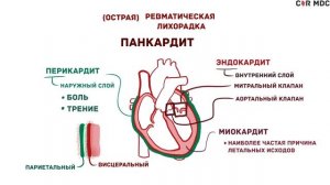 Ревматическая лихорадка и ревматическое заболевание сердца - причины, симптомы, диагностика, лечени
