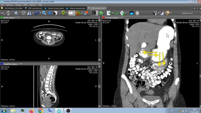 ПЕРВОЕ КТ С ПОЛНОЙ ПОДГОТОВКОЙ . смотреть онлайн