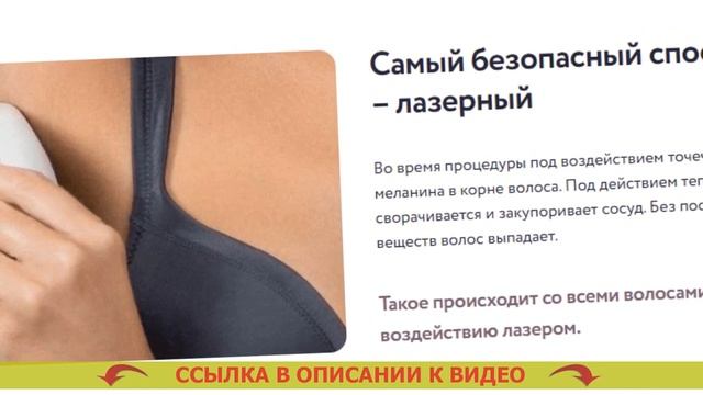 Лучший лазерный эпилятор отзывы