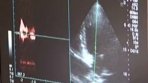 УЗИ - диагностика сосудов головы и шеи в Медицинском центре Панацея