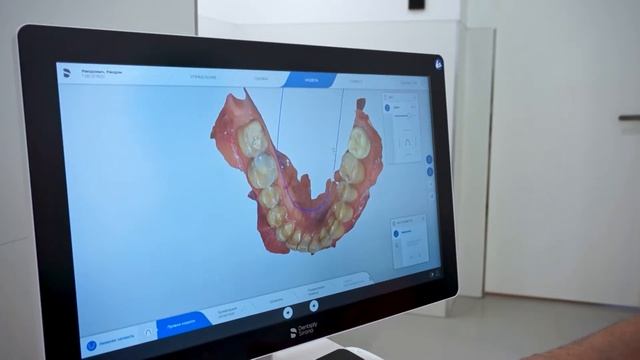 Шаповалов Альберт Сергеевич о внутриротовом сканере Sirona Primescan и вообще о сканировании зубов