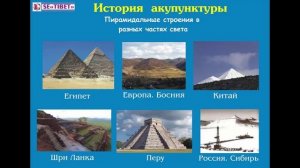 история акупунктуры