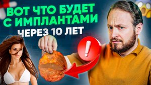 Осложнения после увеличения груди. Как часто менять импланты? (это важно знать!)
