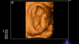 3 4 D плода 12 недель беременности