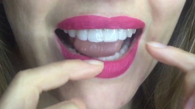 Ретенционная капа смотреть онлайн