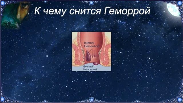 К чему снится Геморрой (Сонник) смотреть онлайн