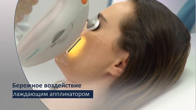 Фотоомоложение М22
