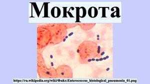 Мокрота