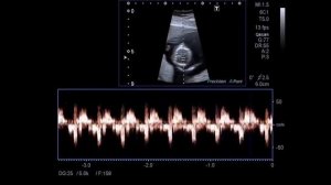 ЧТО НЕ ЛЮБИТ ПЛОД ВО ВРЕМЯ БЕРЕМЕННОСТИ | 10 вещей которые не нравятся ребенку пока вы беременны