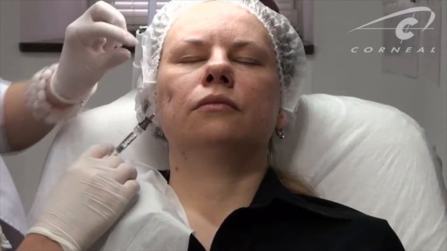 Коррекция средней трети из одного доступа канюлей смотреть онлайн