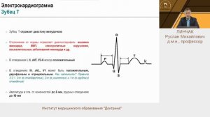 Нормальная ЭКГ