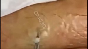Relax squeezing out blackheads #56 Черные точки