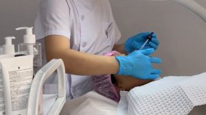 Азелаиновый пилинг для лица. Сезон пилингов | Уход за кожей | Медцентр Aesthetic Med Bishkek