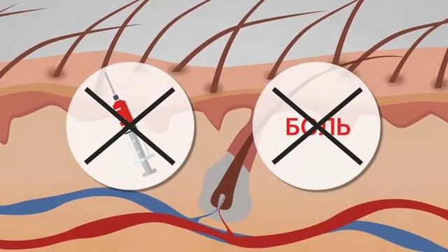 Как работает кислородная эмульсия от компании Perfleor против выпадения и для роста волос смотреть онлайн