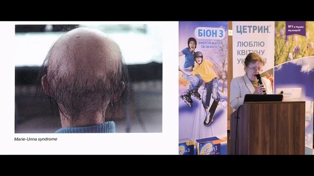 Класифікація хвороб волосся