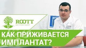 ☝ Как и сколько времени длится приживление импланта. Признаки отторжения имплантата.