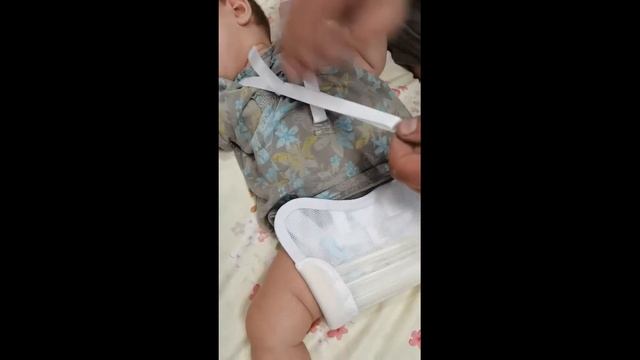 дисплазия тазобедренного сустава