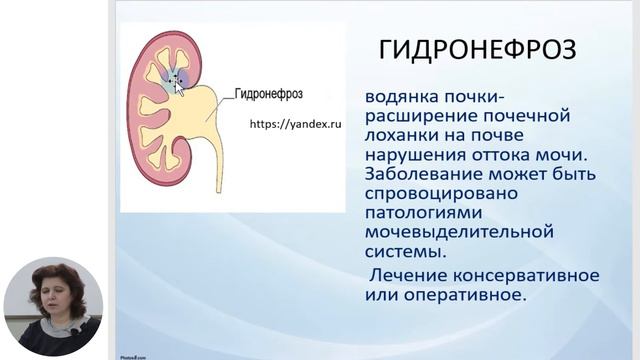 11й класс; Биология; Гигиена, дисфункции и заболевания мочевыделительной системы смотреть онлайн