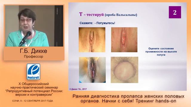 Дисфункция тазового дна проблема молоды Начни с себя Лекция проф Дикке ГБ смотреть онлайн