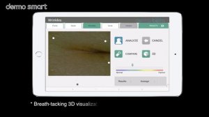Анализатор кожи DermoSmartVISO, CHOWIS