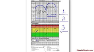 Нетипичные циклы. НЛФ - Урок 2-2(продолжение).