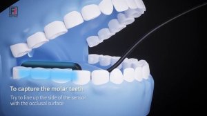 Refine Визиограф R1,R2 инструкция по использованию датчика
