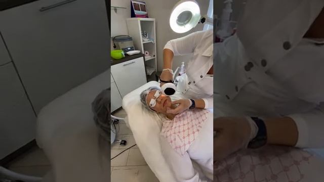 Фотоомоложение на Lumecca Inmode