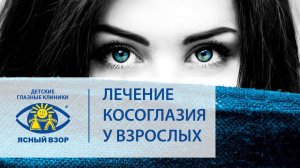 Косоглазие у взрослых.  Успешное лечение косоглазия у взрослых! Ясный взор