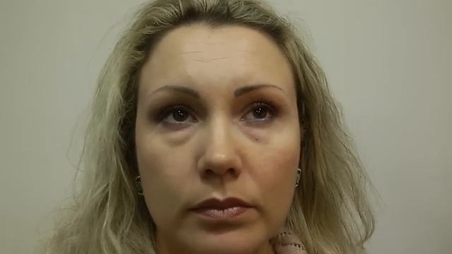 Как быстро избавиться от некрасивых мешков под глазами! Результат потрясающий!