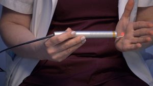 "Удаление гемангиомы лазером "