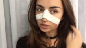 РИНОСЕПТОПЛАСТИКА ДЕНЬ 7/ СНЯТИЕ СПЛИНТОВ, УХОД ЗА НОСОМ И ПОДУШКА