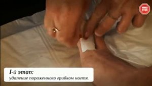 МИКОСТОП крем-паста и лосьон