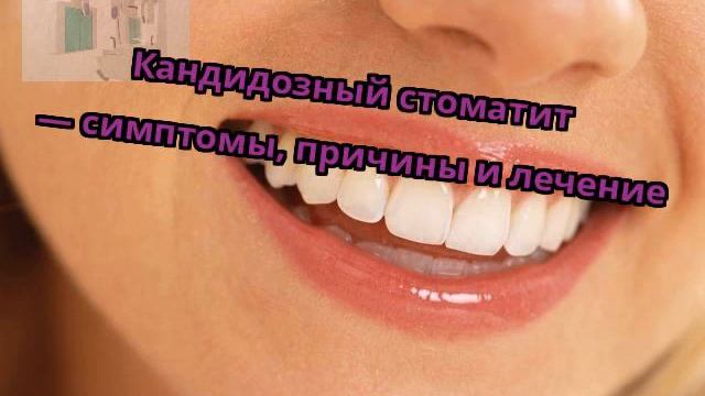 Кандидозный стоматит — симптомы, причины и лечение смотреть онлайн