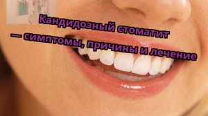 Кандидозный стоматит — симптомы, причины и лечение