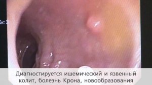 Колоноскопия в клинике "Медицея"