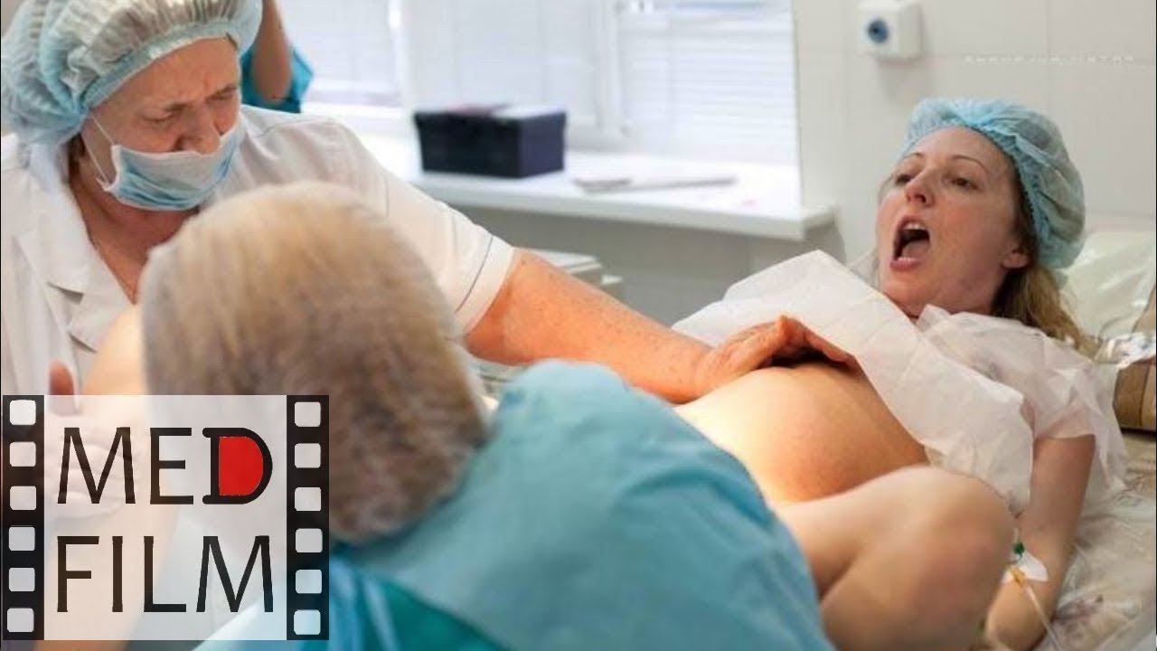 Роды. Эпидуральная (перидуральная) анестезия © Сhildbirth. Epidural anesthesia смотреть онлайн