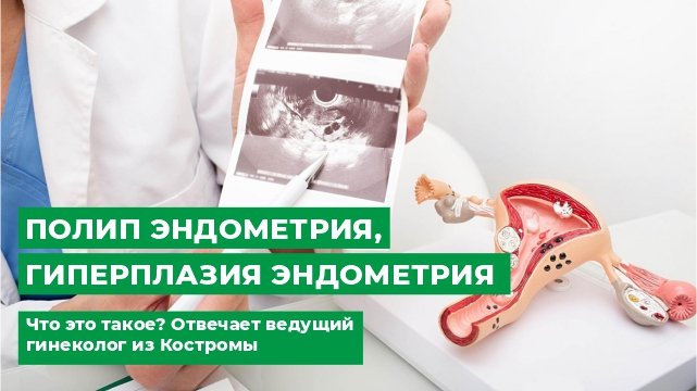 Полип эндометрия гиперплазия эндометрия. Что это такое. Отвечает ведущий гинеколог из Костромы.
