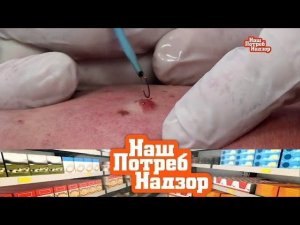 "НашПотребНадзор": все о родинках и бородавках и чудо-упражнения для похудения (10.02.2019)