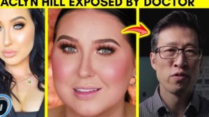 Woman Addicted To Face Filler Says It Gets Her More Romantic Attention