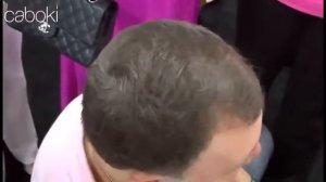 СОЗДАЙТЕ ЭФФЕКТ ГУСТЫХ ВОЛОС ! Средство от облысения для мужчин купить! От фирмы  FULLY