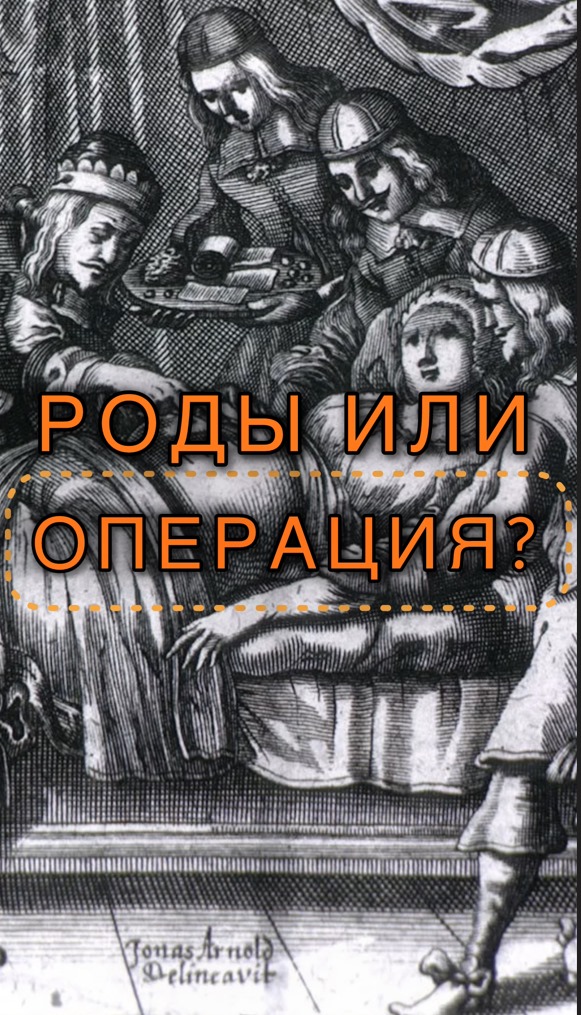 Самая древняя операция