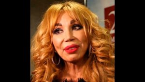 Звёзды после НЕУДАЧНОЙ ПЛАСТИКИ