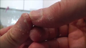 Как очистить руки от супер клея в домашних условиях ?